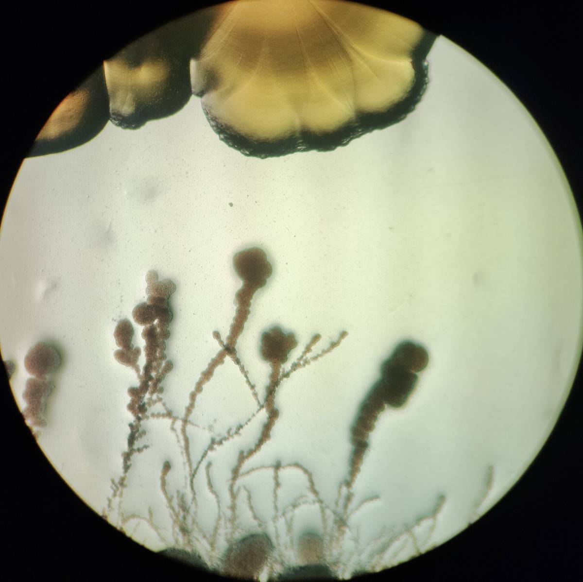 Microscope view of bacteria colonies