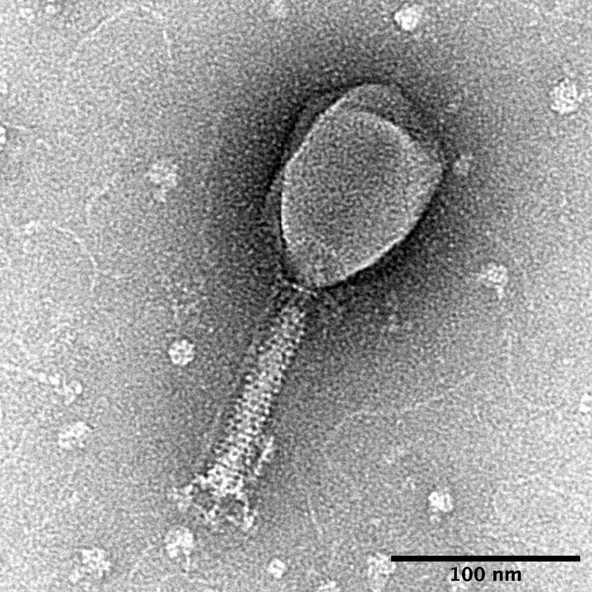 Transmission electron micrograph of Enterobacteria phage T2, a bacteriophage that infects E. coli